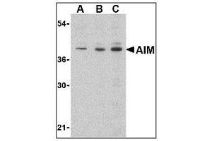 Image no. 1 for anti-CD5 Molecule-Like (CD5L) (C-Term) antibody (ABIN200118) (CD5L 抗体  (C-Term))