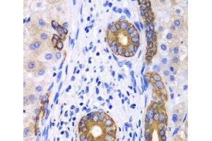 Immunohistochemistry (Paraffin-embedded Sections) (IHC (p)) image for anti-Keratin 19 (KRT19) antibody (ABIN7254829)