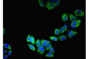 Immunofluorescent analysis of HepG2 cells using ABIN7158804 at dilution of 1:100 and Alexa Fluor 488-congugated AffiniPure Goat Anti-Rabbit IgG(H+L) (LAMP2 抗体  (AA 54-268))