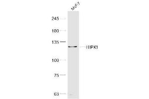 MCF-7 lysates probed with HIPK1 Polyclonal Antibody, Unconjugated  at 1:300 dilution and 4˚C overnight incubation.