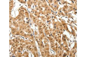 Immunohistochemistry (IHC) image for anti-Microtubule-Associated Protein 1A (MAP1A) antibody (ABIN2426948) (MAP1A 抗体)
