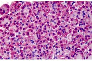 Human Pancreas: Formalin-Fixed, Paraffin-Embedded (FFPE) (TRAF3 抗体  (N-Term))