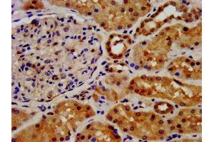 IHC image of ABIN7152853 diluted at 1:500 and staining in paraffin-embedded human kidney tissue performed on a Leica BondTM system. (FGFRL1 抗体  (AA 403-470))
