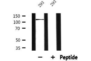 Western blot analysis of extracts from 293, using ATXN2L Antibody. (Ataxin 2-Like 抗体  (Internal Region))