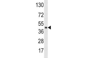 Western blot analysis of SKP2 antibody and HeLa lysate. (SKP2 抗体  (AA 156-185))