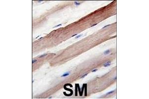 Formalin-fixed and paraffin-embedded human skeletal muscle reacted with Autophagy G4B Antibody  1809d , which was peroxidase-conjugated to the secondary antibody, followed by DAB staining. (ATG4B 抗体  (AA 258-284))