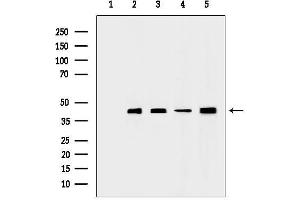 Western blot analysis of lysates from various samples, using Actin alpha 1 Antibody.
