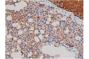 Immunohistochemistry (IHC) image for anti-V-Akt Murine Thymoma Viral Oncogene Homolog 1 (AKT1) (pSer124) antibody (ABIN6256119)