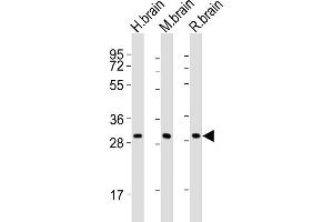 All lanes : Anti-KCNMB2 Antibody (C-term) at 1:2000 dilution Lane 1: human brain lysates Lane 2: mouse brain lysates Lane 3: rat brain lysates Lysates/proteins at 20 μg per lane. (KCNMB2 抗体  (C-Term))