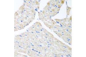 Immunohistochemistry of paraffin-embedded mouse heart using G antibody (ABIN6129967, ABIN6140880, ABIN6140881 and ABIN6223736) at dilution of 1:200 (40x lens). (GABARAPL2 抗体  (AA 1-117))