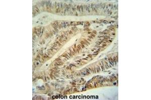 Immunohistochemistry (IHC) image for anti-Cullin 5 (CUL5) antibody (ABIN3003301) (Cullin 5 抗体)