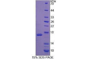 SDS-PAGE analysis of Mouse WISP1 Protein. (WISP1 蛋白)