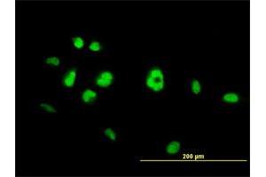 Immunofluorescence (IF) image for anti-Nuclear Receptor Subfamily 4, Group A, Member 3 (NR4A3) (AA 414-521) antibody (ABIN521726)