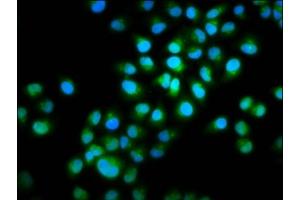Immunofluorescence staining of Hela cells with ABIN7165653 at 1:100, counter-stained with DAPI. (INTU 抗体  (AA 6-139))