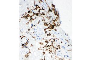 Anti-HYAL1 antibody,  IHC(F) IHC(F): Human Placenta Tissue (HYAL1 抗体  (N-Term))
