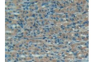 Detection of C1INH in Rat Intestine Tissue using Polyclonal Antibody to Complement 1 Inhibitor (C1INH)