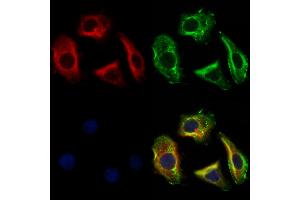 ABIN6261824 and ABIN6273118 staining Hela cells by IF/ICC.