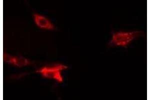 ABIN6275831 staining  Hela cells by IF/ICC. (TRAF2 抗体  (C-Term))