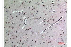 Immunohistochemistry (IHC) analysis of paraffin-embedded Human Brain, antibody was diluted at 1:100. (Midkine 抗体  (Internal Region))