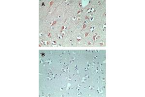 IHC staining of FAM3C using FAM3C polyclonal antibody  in normal human brain at 5 ug/mL (using control rabbit Ig for figure B). (FAM3C 抗体  (AA 40-80))