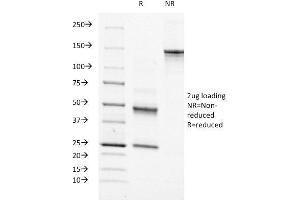 SDS-PAGE (SDS) image for anti-Moesin (MSN) antibody (ABIN6940082)