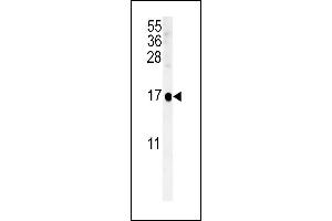 SIKE Antibody (C-term) (ABIN651568 and ABIN2840305) western blot analysis in NCI- cell line lysates (35 μg/lane). (SIKE1 抗体  (C-Term))