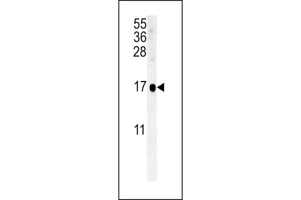 SIKE1 抗体  (C-Term)