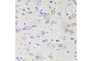 Immunohistochemistry of paraffin-embedded rat brain using GNE antibody (ABIN5996449) at dilution of 1/100 (40x lens). (GNE 抗体)