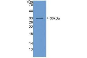 Detection of Recombinant LIPD, Human using Polyclonal Antibody to Lipoprotein lipase (LPL) (Lipoprotein Lipase 抗体  (AA 55-316))