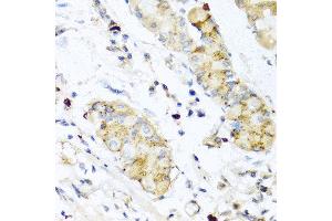 Immunohistochemistry of paraffin-embedded human stomach using IFNL3 antibody at dilution of 1:100 (40x lens). (IL28B 抗体)