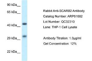 Western Blotting (WB) image for anti-Scavenger Receptor Class B, Member 2 (SCARB2) (N-Term) antibody (ABIN2788867) (SCARB2 抗体  (N-Term))