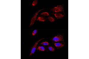 Confocal immunofluorescence analysis of U2OS cells using H Polyclonal Antibody (ABIN6131125, ABIN6137333, ABIN6137334 and ABIN6220624) at dilution of 1:100. (ATP5H 抗体  (AA 1-161))