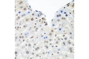Immunohistochemistry of paraffin-embedded mouse liver using TARDBP antibody at dilution of 1:100 (40x lens). (TARDBP 抗体)
