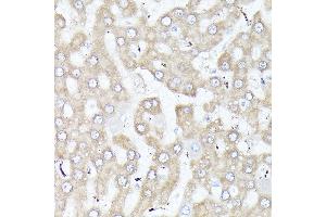 Immunohistochemistry of paraffin-embedded rat liver using DBI Rabbit pAb (ABIN6127407, ABIN6139420, ABIN6139422 and ABIN6217234) at dilution of 1:250 (40x lens).