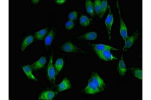Immunofluorescent analysis of Hela cells using ABIN7174011 at dilution of 1:100 and Alexa Fluor 488-congugated AffiniPure Goat Anti-Rabbit IgG(H+L) (BTK 抗体  (AA 254-443))