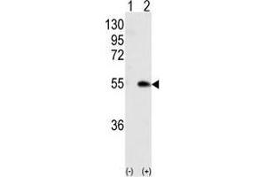 Western blot analysis of CAMK1G (arrow) using rabbit polyclonal CAMK1G (Center) Antibody . (CAMK1G 抗体  (Center))