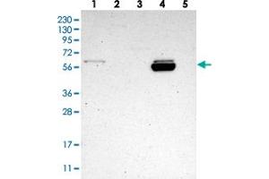 Western blot analysis of Lane 1: RT-4, Lane 2: U-251 MG, Lane 3: Human Plasma, Lane 4: Liver, Lane 5: Tonsil with ALDH1A2 polyclonal antibody . (ALDH1A2 抗体)