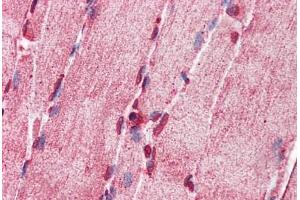 Human Skeletal Muscle: Formalin-Fixed, Paraffin-Embedded (FFPE) (ACSL5 抗体  (AA 470-519))