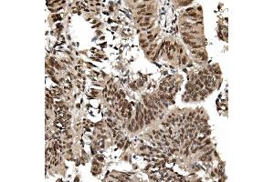 IHC analysis of TIF1 gamma/TRIM33 using anti TIF1 gamma/TRIM33 antibody (ABIN7599621). (TRIM33 抗体  (AA 1001-1127))