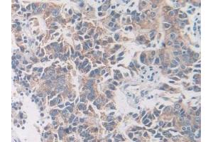 Immunohistochemistry (IHC) image for anti-Solute Carrier Family 12 (Sodium/Chloride Transporters), Member 3 (SLC12A3) (AA 867-1024) antibody (ABIN7441745)