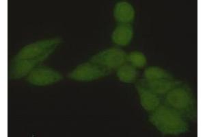 Immunocytochemistry stain of Hela using Hsp70 (N-terminus) mouse mAb (1:300).