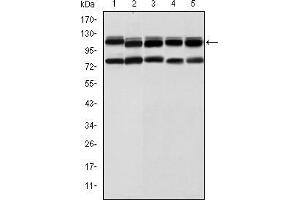 Western blot analysis using BMPR2 mouse mAb against Hela (1), A431 (2), NIH/3T3 (3), Cos7 (4) and PC-12 (5) cell lysate. (BMPR2 抗体)