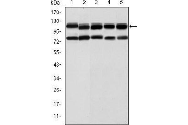 BMPR2 抗体