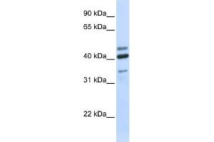 Western Blotting (WB) image for anti-Hyaluronidase-1 (HYAL1) (N-Term) antibody (ABIN2784343)