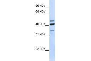 WB Suggested Anti-HYAL1 Antibody Titration:  0. (HYAL1 抗体  (N-Term))