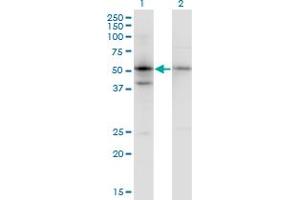 Western Blot analysis of SERPINB1 expression in transfected 293T cell line by SERPINB1 monoclonal antibody (M02), clone 4D7.