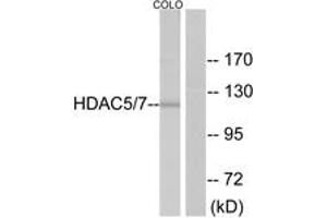 Western blot analysis of extracts from NIH-3T3 cells, using HDAC5 (Ab-498) Antibody. (HDAC5 抗体  (AA 464-513))