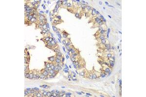 Immunohistochemistry of paraffin-embedded human prostate using KLK10 antibody at dilution of 1:100 (40x lens). (Kallikrein 10 抗体)