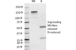 SDS-PAGE Analysis Purified Insulin Mouse Monoclonal Antibody (E2-E3). (Insulin 抗体)