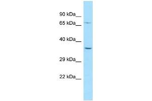 WB Suggested Anti-PALMD Antibody Titration: 1. (PALMD 抗体  (N-Term))